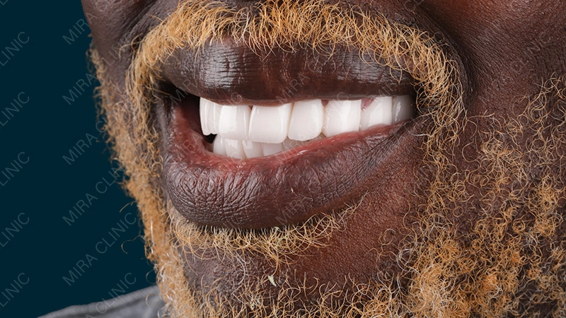 hollywood smile patient experience 